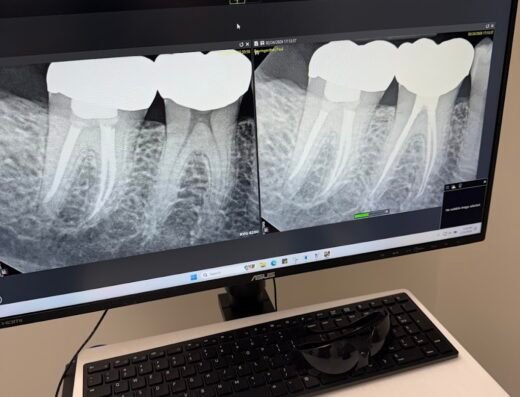 Memphis Endodontics